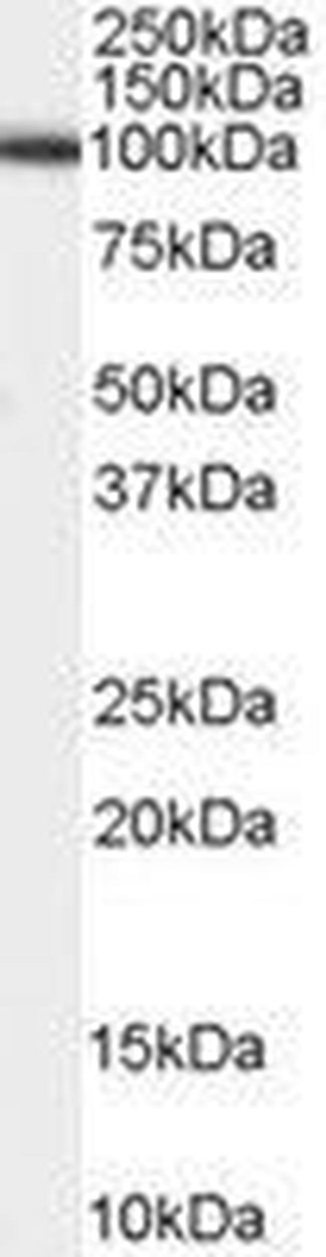 ADAM17 Antibody in Western Blot (WB)