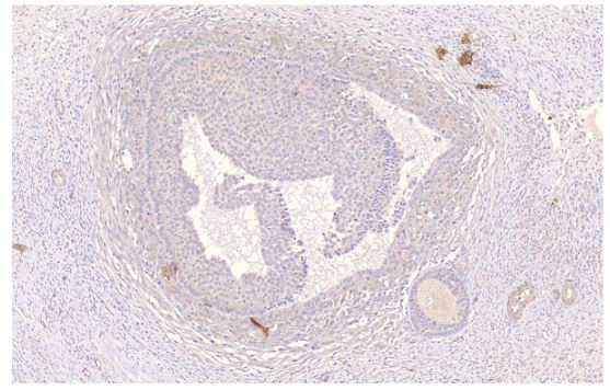 PDE4D Antibody in Immunohistochemistry (Paraffin) (IHC (P))