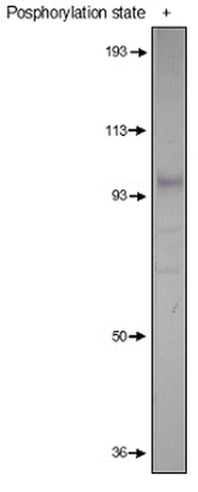 PDE4D Antibody in Western Blot (WB)