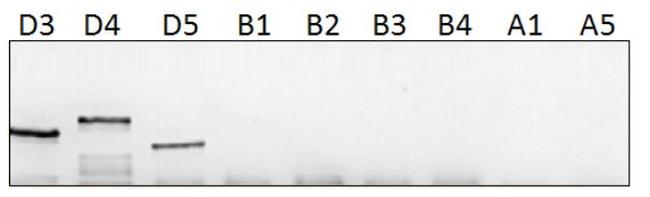 PDE4D Antibody in Western Blot (WB)