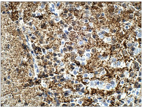 Calretinin Antibody in Immunohistochemistry (Paraffin) (IHC (P))