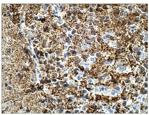 Calretinin Antibody in Immunohistochemistry (Paraffin) (IHC (P))