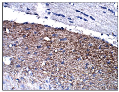 Calretinin Antibody in Immunohistochemistry (Paraffin) (IHC (P))