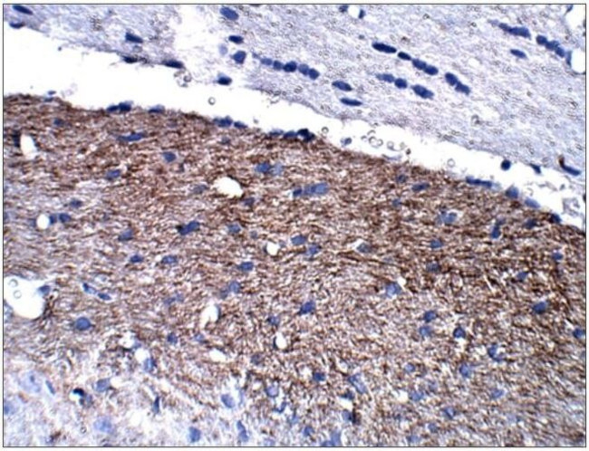 Calretinin Antibody in Immunohistochemistry (Paraffin) (IHC (P))