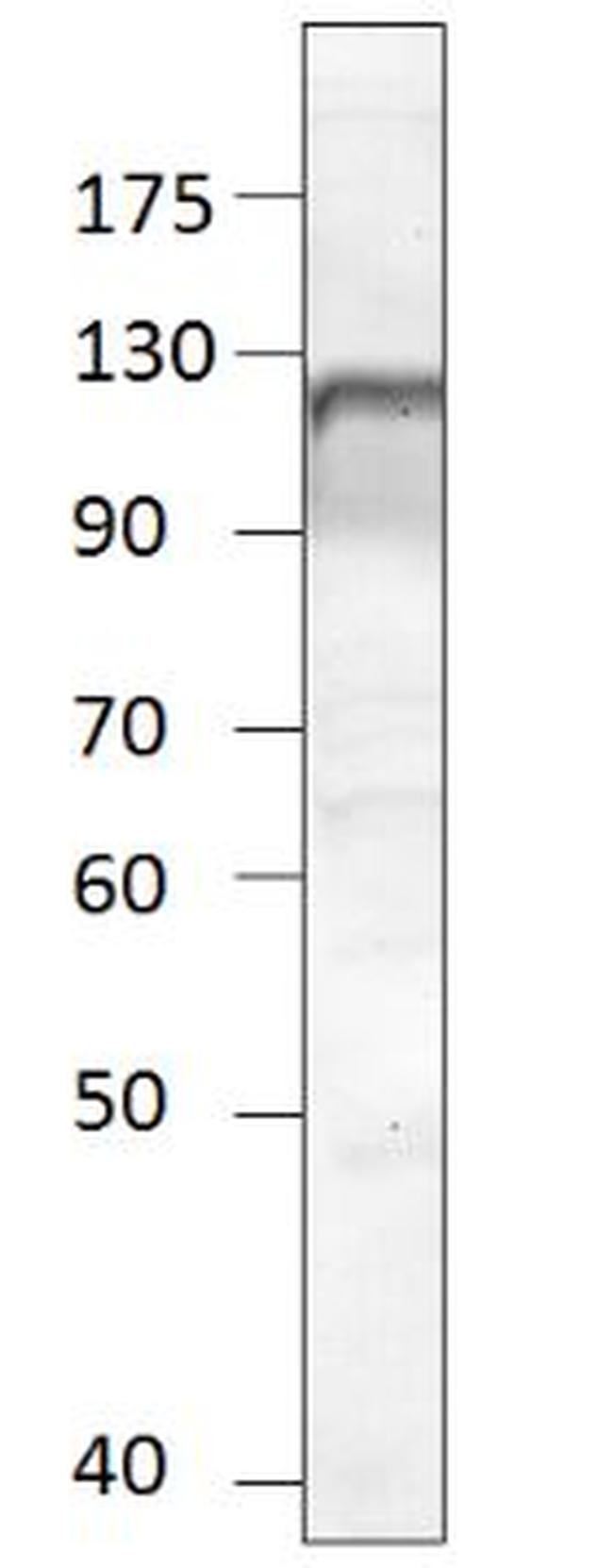 NPR1 Antibody in Western Blot (WB)