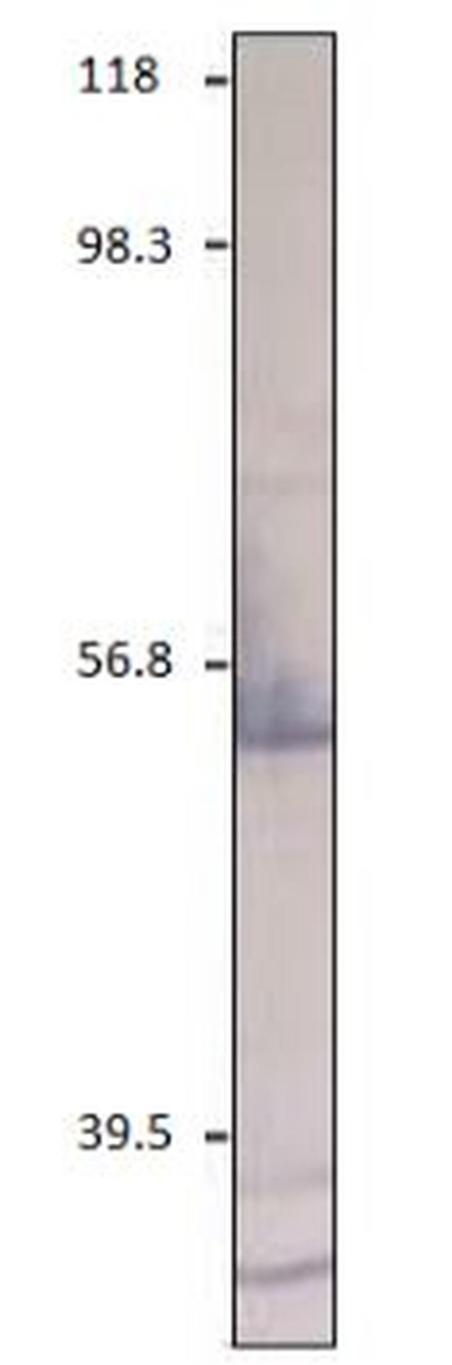 CXCR2 Antibody in Western Blot (WB)