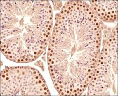 SCP3 Antibody in Immunohistochemistry (Paraffin) (IHC (P))