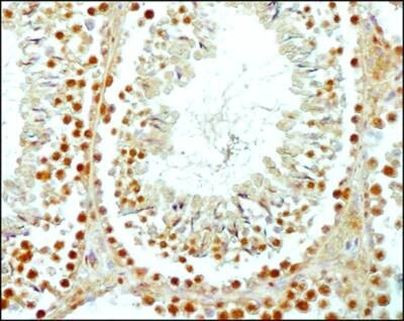 SCP3 Antibody in Immunohistochemistry (Paraffin) (IHC (P))