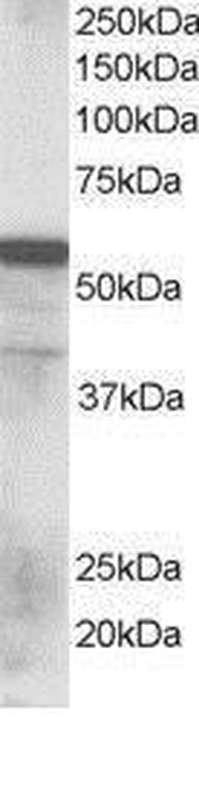 RNF8 Antibody in Western Blot (WB)