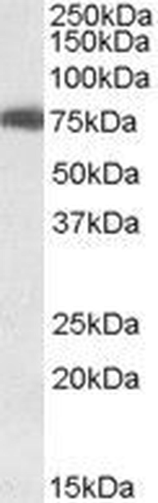 USH1C Antibody in Western Blot (WB)