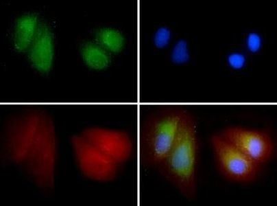 LIMP2 Antibody in Immunocytochemistry (ICC/IF)