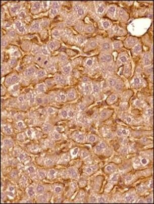 SR-BI Antibody in Immunohistochemistry (Paraffin) (IHC (P))