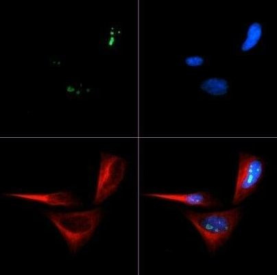 p14ARF Antibody in Immunocytochemistry (ICC/IF)