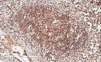 GRB2 Antibody in Immunohistochemistry (Paraffin) (IHC (P))