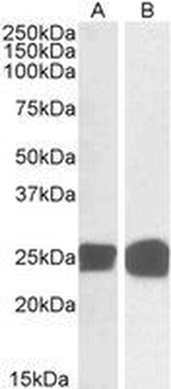 GRB2 Antibody in Western Blot (WB)