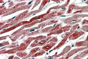 COX1 Antibody in Immunohistochemistry (Paraffin) (IHC (P))