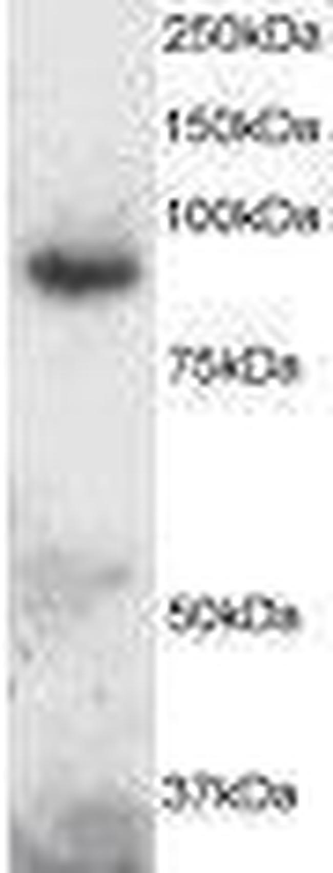 ADAM8 Antibody in Western Blot (WB)