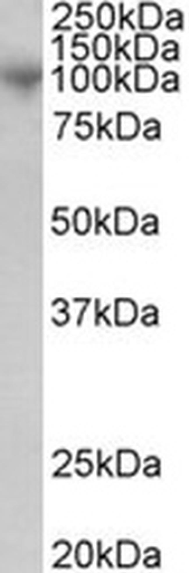 ADAM8 Antibody in Western Blot (WB)