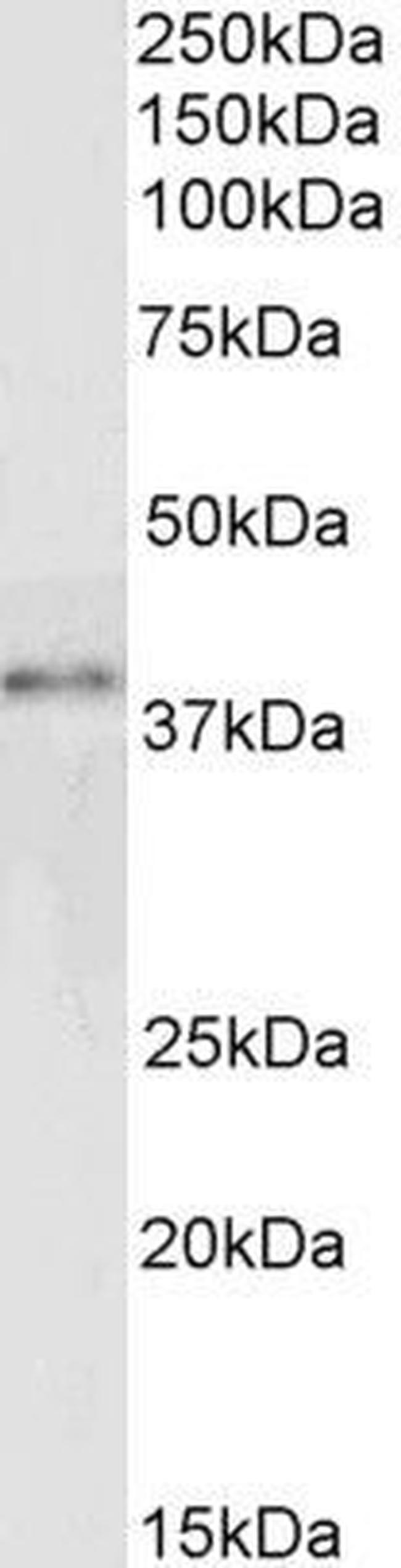 GRAP2 Antibody in Western Blot (WB)