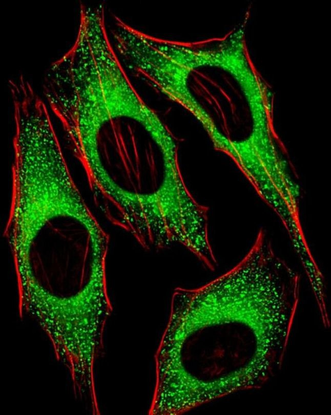 FGFR2 Antibody in Immunocytochemistry (ICC/IF)