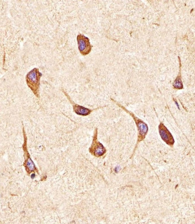 FGFR2 Antibody in Immunohistochemistry (Paraffin) (IHC (P))