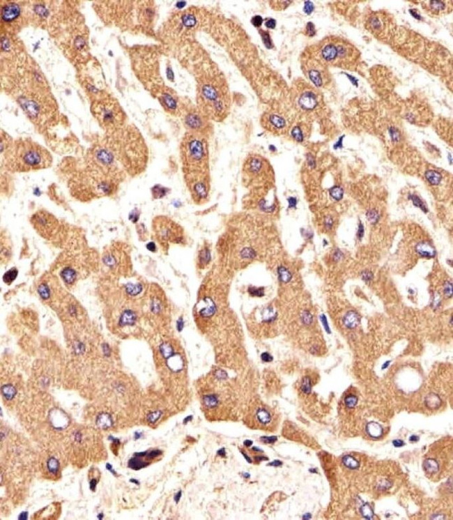 FGFR2 Antibody in Immunohistochemistry (Paraffin) (IHC (P))