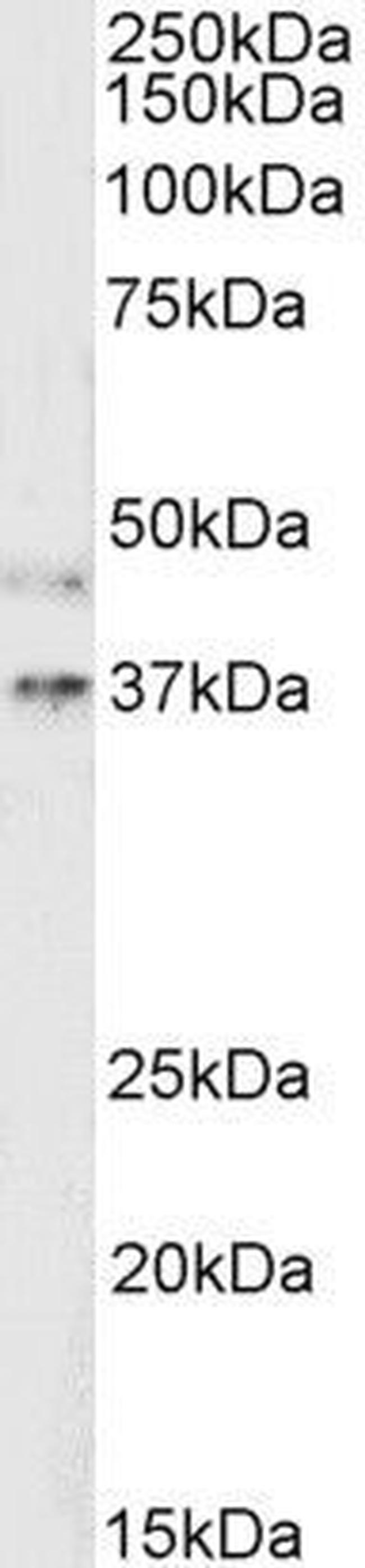 ATP6IP2 Antibody in Western Blot (WB)