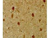 p130 Antibody in Immunohistochemistry (Paraffin) (IHC (P))