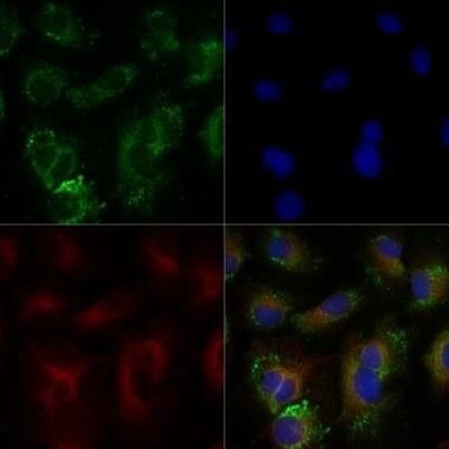 ABCA1 Antibody in Immunocytochemistry (ICC/IF)