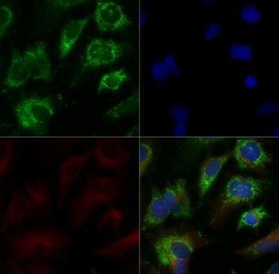 ABCA1 Antibody in Immunocytochemistry (ICC/IF)