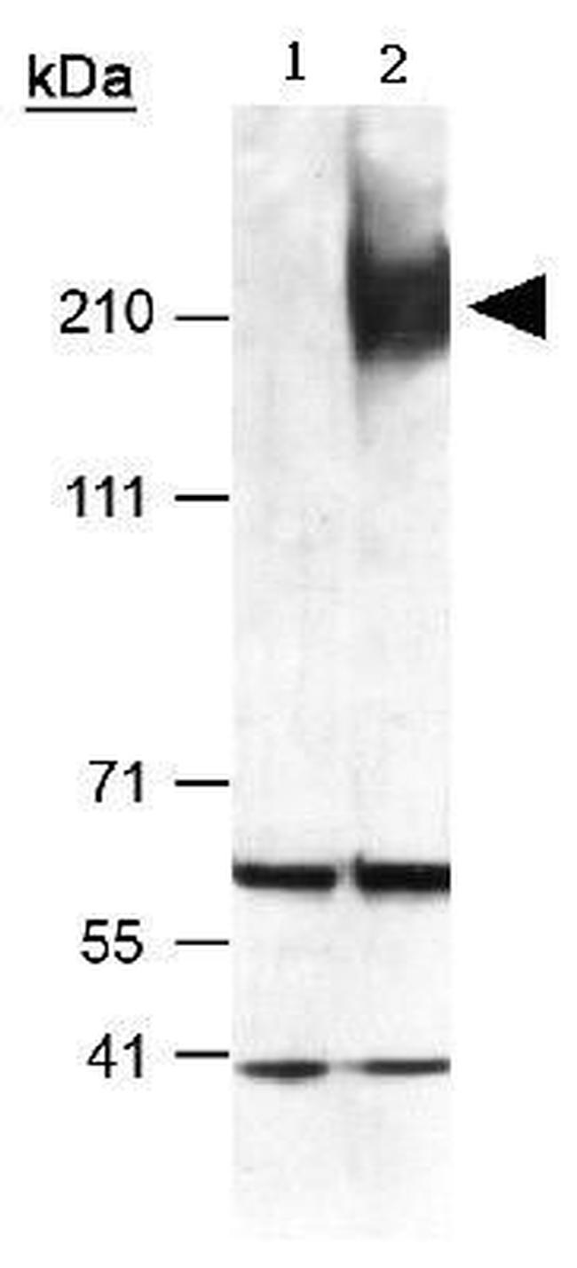 ABCA1 Antibody in Western Blot (WB)