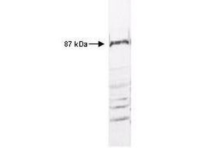 IKK beta Antibody in Western Blot (WB)