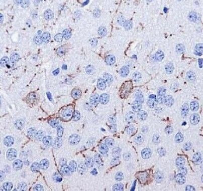 TACR1 Antibody in Immunohistochemistry (Paraffin) (IHC (P))