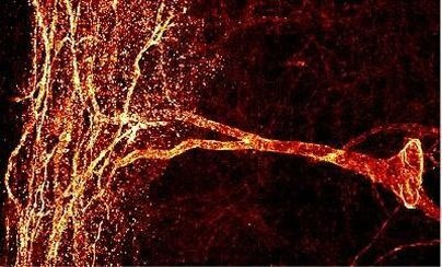 TACR1 Antibody in Immunohistochemistry (Paraffin) (IHC (P))