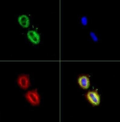 FASN Antibody in Immunocytochemistry (ICC/IF)