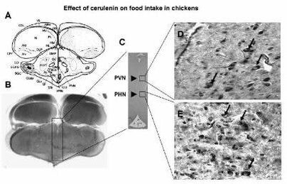 FASN Antibody in Immunohistochemistry (Paraffin) (IHC (P))