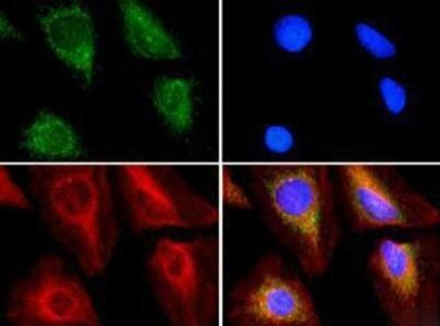 ABCE1 Antibody in Immunocytochemistry (ICC/IF)