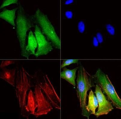 SR-BI/SR-BII Antibody in Immunocytochemistry (ICC/IF)