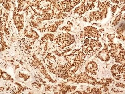 NuMA Antibody in Immunohistochemistry (Paraffin) (IHC (P))