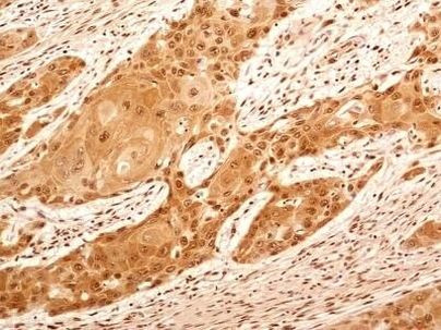 NuMA Antibody in Immunohistochemistry (Paraffin) (IHC (P))