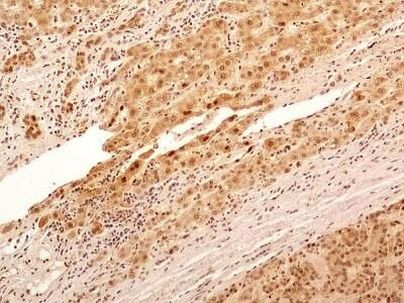 NuMA Antibody in Immunohistochemistry (Paraffin) (IHC (P))