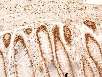 NuMA Antibody in Immunohistochemistry (Paraffin) (IHC (P))