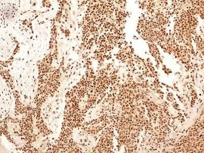 NuMA Antibody in Immunohistochemistry (Paraffin) (IHC (P))