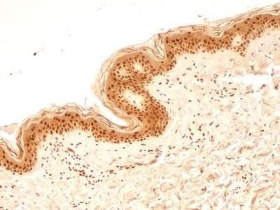 NuMA Antibody in Immunohistochemistry (Paraffin) (IHC (P))