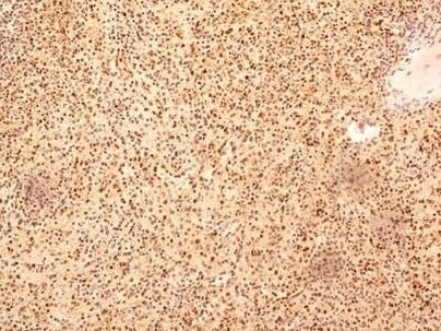 NuMA Antibody in Immunohistochemistry (Paraffin) (IHC (P))