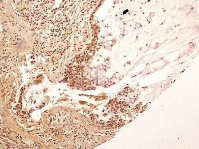 NuMA Antibody in Immunohistochemistry (Paraffin) (IHC (P))