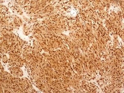 NuMA Antibody in Immunohistochemistry (Paraffin) (IHC (P))