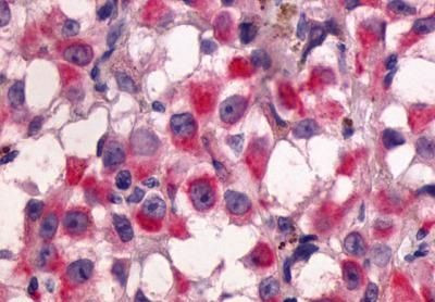 GPR64 Antibody in Immunohistochemistry (Paraffin) (IHC (P))