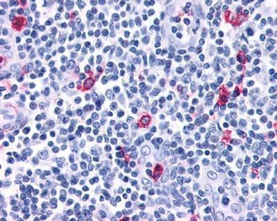 CXCR3 Antibody in Immunohistochemistry (Paraffin) (IHC (P))