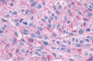 CXCR3 Antibody in Immunohistochemistry (Paraffin) (IHC (P))